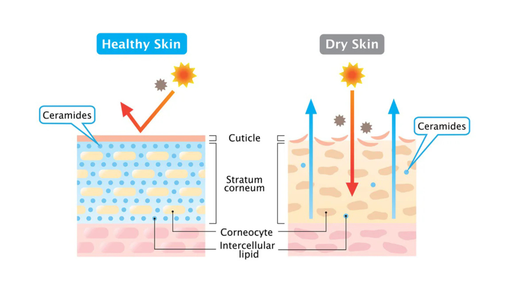 3 signs of ceramide blockage